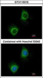 Anti-Valyl tRNA synthetase antibody [N1N2], N-term used in Immunocytochemistry/ Immunofluorescence (ICC/IF). GTX115015