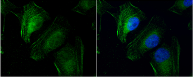Anti-Transgelin 2 antibody [N1C3] used in Immunocytochemistry/ Immunofluorescence (ICC/IF). GTX115082