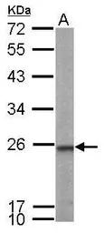 Anti-Transgelin 2 antibody [N1C3] used in Western Blot (WB). GTX115082