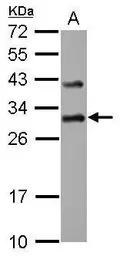 Anti-DENR antibody used in Western Blot (WB). GTX115106