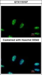 Anti-RRP1 antibody used in Immunocytochemistry/ Immunofluorescence (ICC/IF). GTX115107