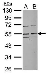 Anti-RRP1 antibody [N2C2], Internal used in Western Blot (WB). GTX115108