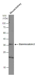 Anti-Stanniocalcin 2 antibody used in Western Blot (WB). GTX115113