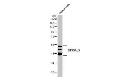 Anti-ST3GAL5 antibody [N3C3] used in Western Blot (WB). GTX115152