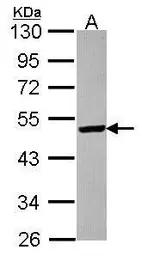 Anti-ST3GAL5 antibody [N3C3] used in Western Blot (WB). GTX115152