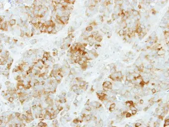 Anti-KYNU antibody [N2C2], Internal used in IHC (Paraffin sections) (IHC-P). GTX115169