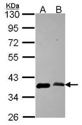 Anti-AIMP1 antibody used in Western Blot (WB). GTX115209