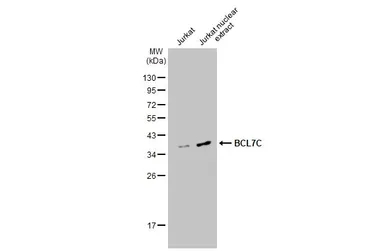 Anti-BCL7C antibody used in Western Blot (WB). GTX115214