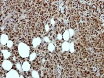 Anti-TRAP80 antibody [C1C3] used in IHC (Paraffin sections) (IHC-P). GTX115241