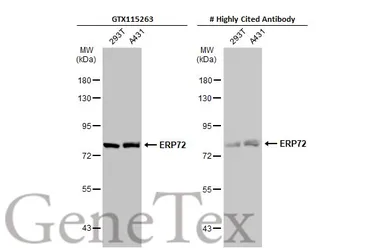 Anti-ERP72 antibody used in Western Blot (WB). GTX115263