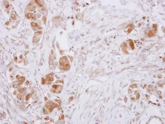 Anti-Guanine deaminase antibody used in IHC (Paraffin sections) (IHC-P). GTX115264