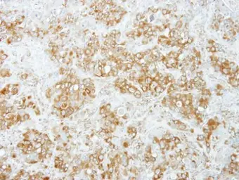 Anti-Pumilio 1 antibody [C2C3], C-term used in IHC (Paraffin sections) (IHC-P). GTX115280