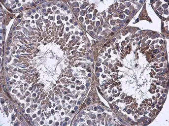 Anti-FARSB antibody used in IHC (Paraffin sections) (IHC-P). GTX115336