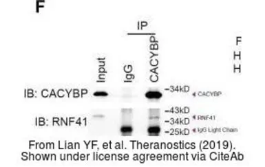 Anti-RNF41 antibody used in Western Blot (WB). GTX115366