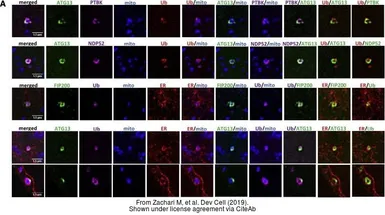 Anti-NDP52 antibody used in Immunocytochemistry/ Immunofluorescence (ICC/IF). GTX115378