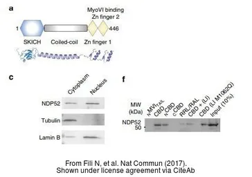 Anti-NDP52 antibody used in Western Blot (WB). GTX115378