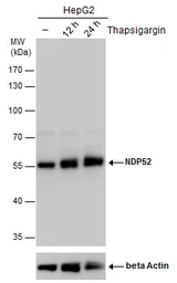 Anti-NDP52 antibody used in Western Blot (WB). GTX115378