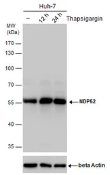 Anti-NDP52 antibody used in Western Blot (WB). GTX115378