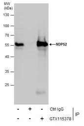 Anti-NDP52 antibody used in Immunoprecipitation (IP). GTX115378