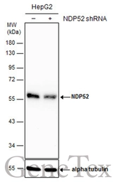 Anti-NDP52 antibody used in Western Blot (WB). GTX115378