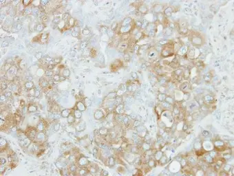 Anti-NDP52 antibody used in IHC (Paraffin sections) (IHC-P). GTX115378