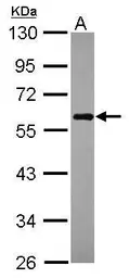 Anti-NDP52 antibody used in Western Blot (WB). GTX115378