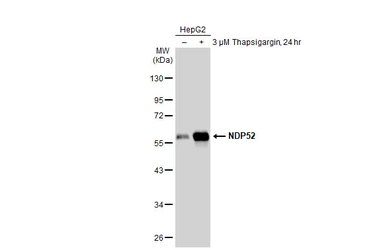 Anti-NDP52 antibody used in Western Blot (WB). GTX115378
