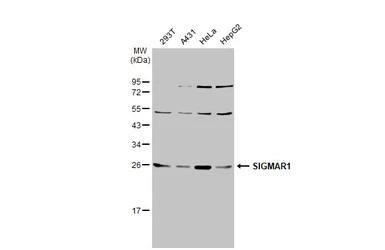 Anti-SIGMAR1 antibody [N1C3] used in Western Blot (WB). GTX115389