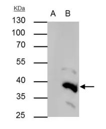 Anti-BRAF35 antibody [N2C3] used in Immunoprecipitation (IP). GTX115399