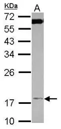 Anti-TIM17 antibody used in Western Blot (WB). GTX115414