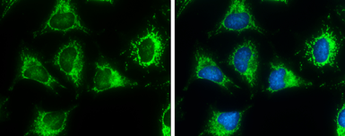 Anti-ACAA2 antibody used in Immunocytochemistry/ Immunofluorescence (ICC/IF). GTX115417