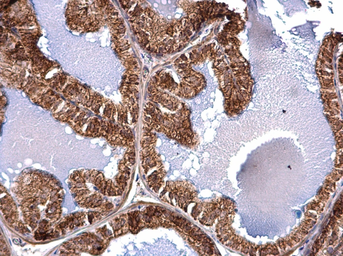 Anti-ACAA2 antibody used in IHC (Paraffin sections) (IHC-P). GTX115417