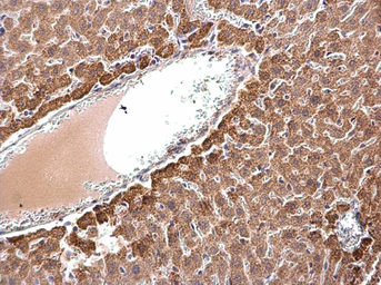 Anti-ACAA2 antibody used in IHC (Paraffin sections) (IHC-P). GTX115417
