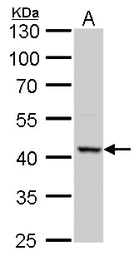 Anti-ACAA2 antibody used in Western Blot (WB). GTX115417