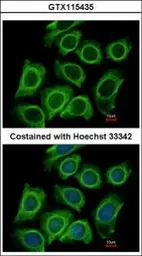 Anti-DCTN2 antibody used in Immunocytochemistry/ Immunofluorescence (ICC/IF). GTX115435