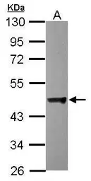 Anti-DCTN2 antibody used in Western Blot (WB). GTX115435