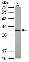 Anti-SCGN antibody [N2C3] used in Western Blot (WB). GTX115443