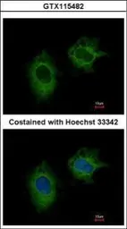 Anti-MTHFD2 antibody [N3C3] used in Immunocytochemistry/ Immunofluorescence (ICC/IF). GTX115482