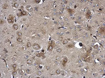 Anti-NTE antibody used in IHC (Paraffin sections) (IHC-P). GTX115501