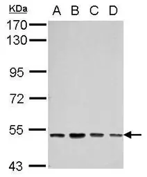Anti-SOX30 antibody used in Western Blot (WB). GTX115541