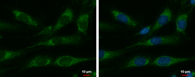 Anti-Cpn10 antibody used in Immunocytochemistry/ Immunofluorescence (ICC/IF). GTX115575