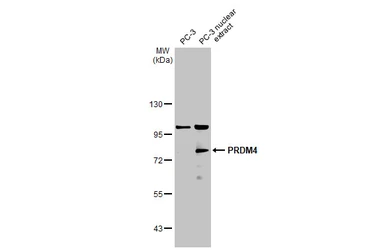 Anti-PRDM4 antibody used in Western Blot (WB). GTX115579