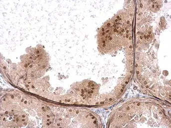 Anti-HELIOS antibody used in IHC (Paraffin sections) (IHC-P). GTX115630