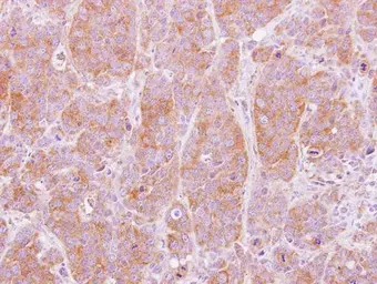 Anti-NT5C2 antibody used in IHC (Paraffin sections) (IHC-P). GTX115657