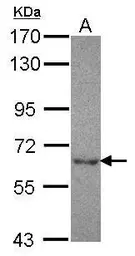 Anti-NT5C2 antibody used in Western Blot (WB). GTX115657
