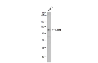Anti-LSD1 antibody used in Western Blot (WB). GTX115660