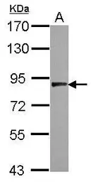Anti-USP33 antibody [C1C3] used in Western Blot (WB). GTX115661