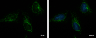 Anti-ACOT9 antibody [N1C1] used in Immunocytochemistry/ Immunofluorescence (ICC/IF). GTX115724