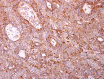 Anti-Coronin 1C antibody [C1C3] used in IHC (Paraffin sections) (IHC-P). GTX115727