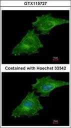 Anti-Coronin 1C antibody [C1C3] used in Immunocytochemistry/ Immunofluorescence (ICC/IF). GTX115727